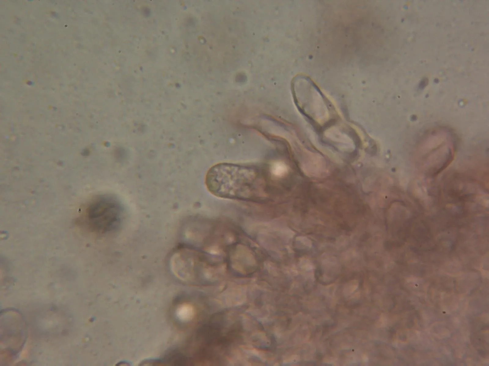 Microscopía de Lactarius atlanticus - 10 - Arista laminar 2